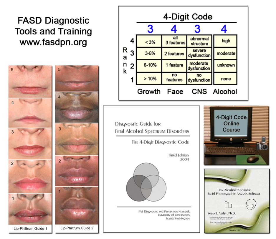 胎兒酒精頻譜異常(FASD)患者的臨牀評估 胎兒酒精頻譜異常(FASD)患者的臨牀評估