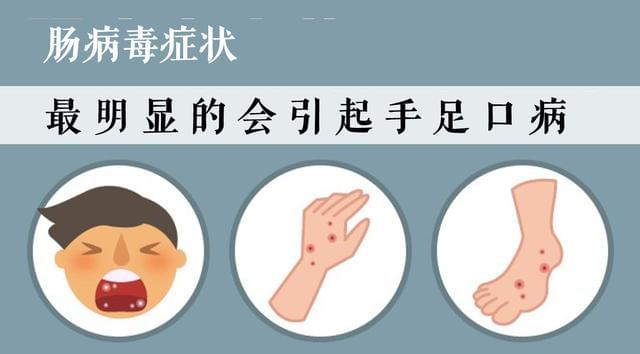 手足口病高發季,家裡有孩子,怎樣讓孩子不「中招」?