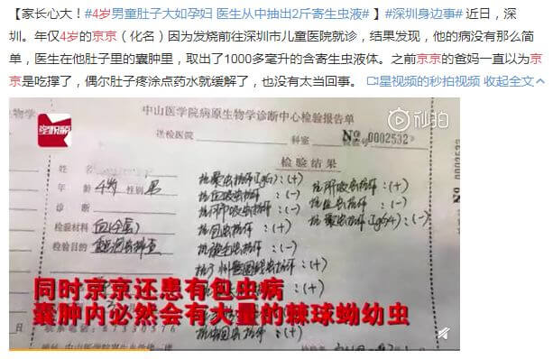 如何判斷孩子肚裡有沒有蟲？5種判斷不行，靠譜方法看2種
