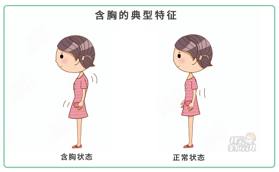 4歲就駝背？這種坐姿、運動對娃的傷害非常大，嚴重要手術