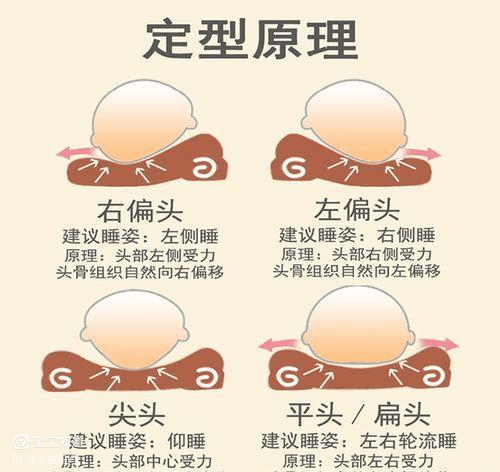 寶寶頭型與智商有關係嗎？ 兒科醫生提醒：別錯過塑造頭型關鍵期