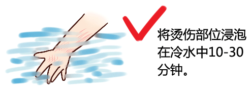 4歲娃燙傷，奶奶1個舉動卻害了他！ 這5字急救法，全家都要學會！