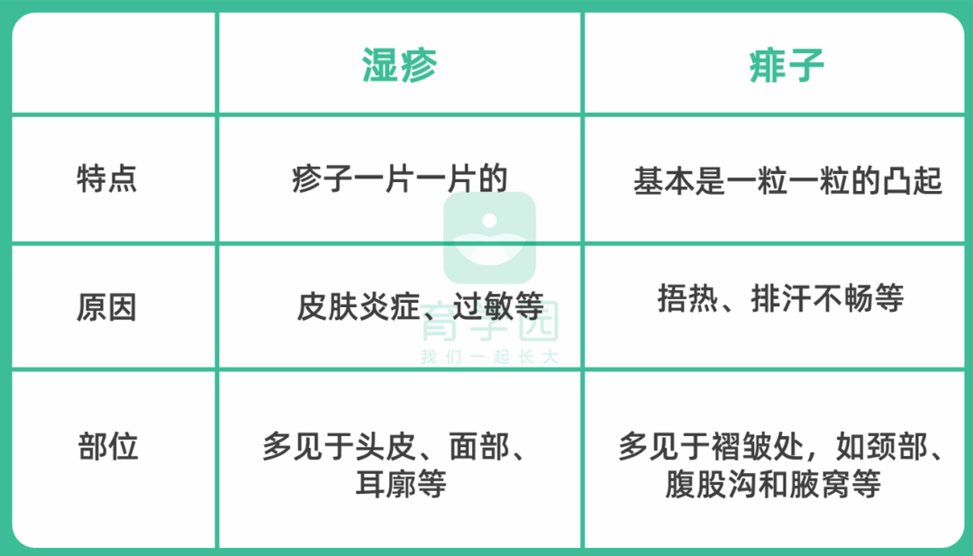 爽身粉、花露水不治痱子！ 這種葯才最管用，家門口藥店就有