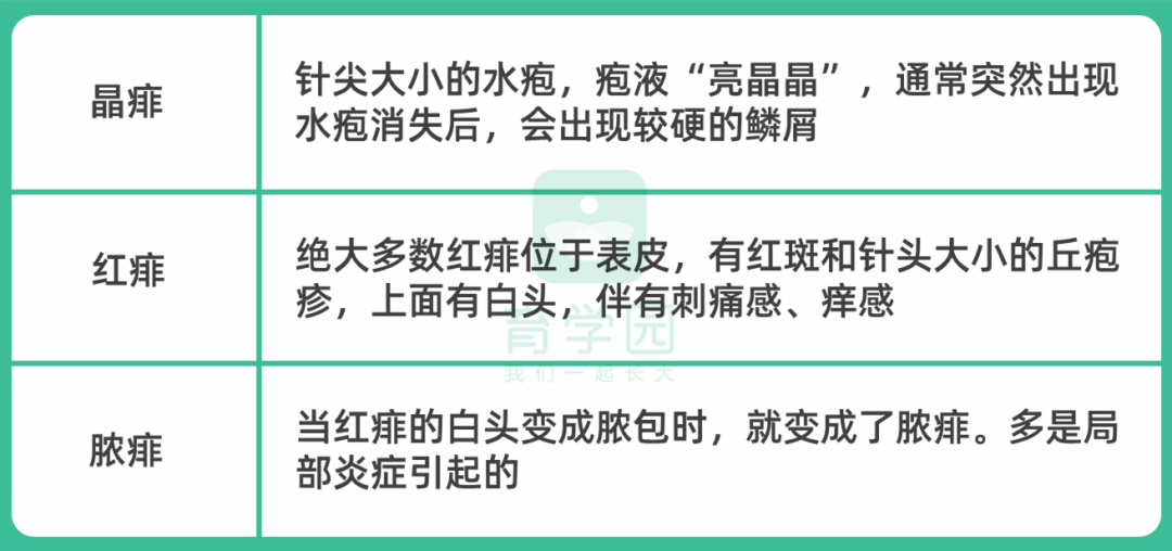 爽身粉、花露水不治痱子！ 這種葯才最管用，家門口藥店就有