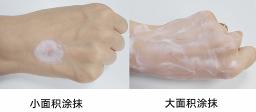 爽身粉、花露水不治痱子！ 這種葯才最管用，家門口藥店就有